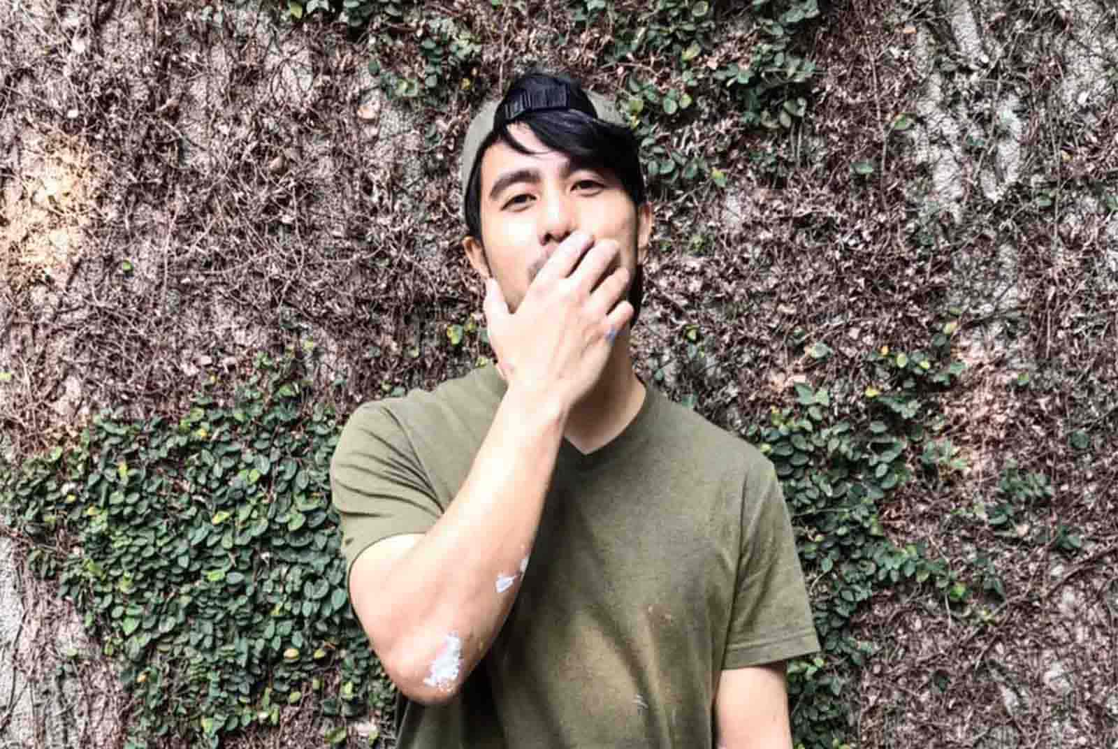 心內膜炎-感染-感冒-死亡-郭彥甫
