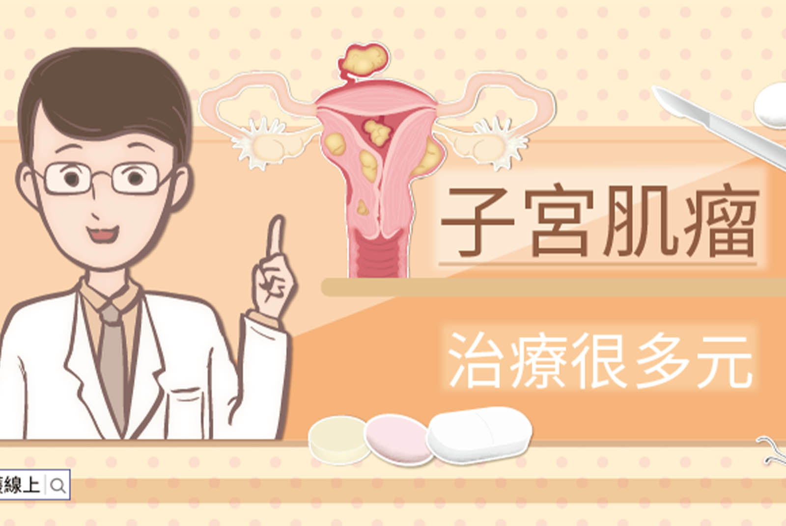 子宮肌瘤-子宮-肌瘤-經痛-不孕