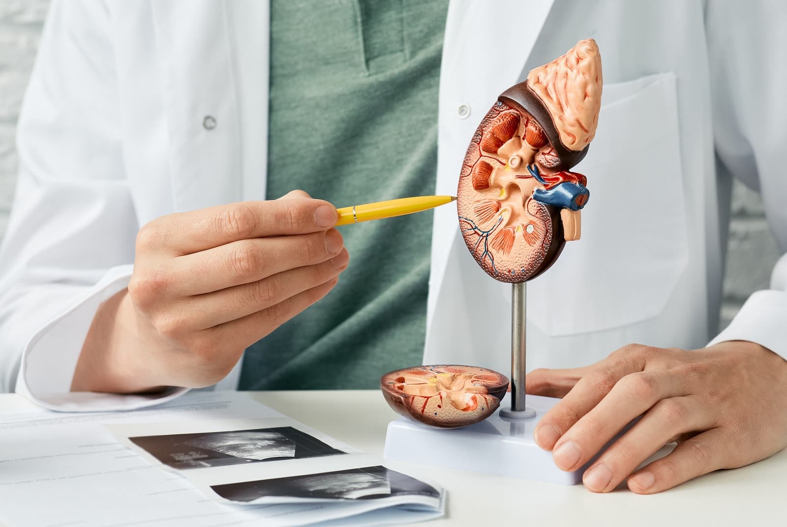 三高引發慢性腎臟病　研究：服用兩類處方中藥，洗腎風險降六成