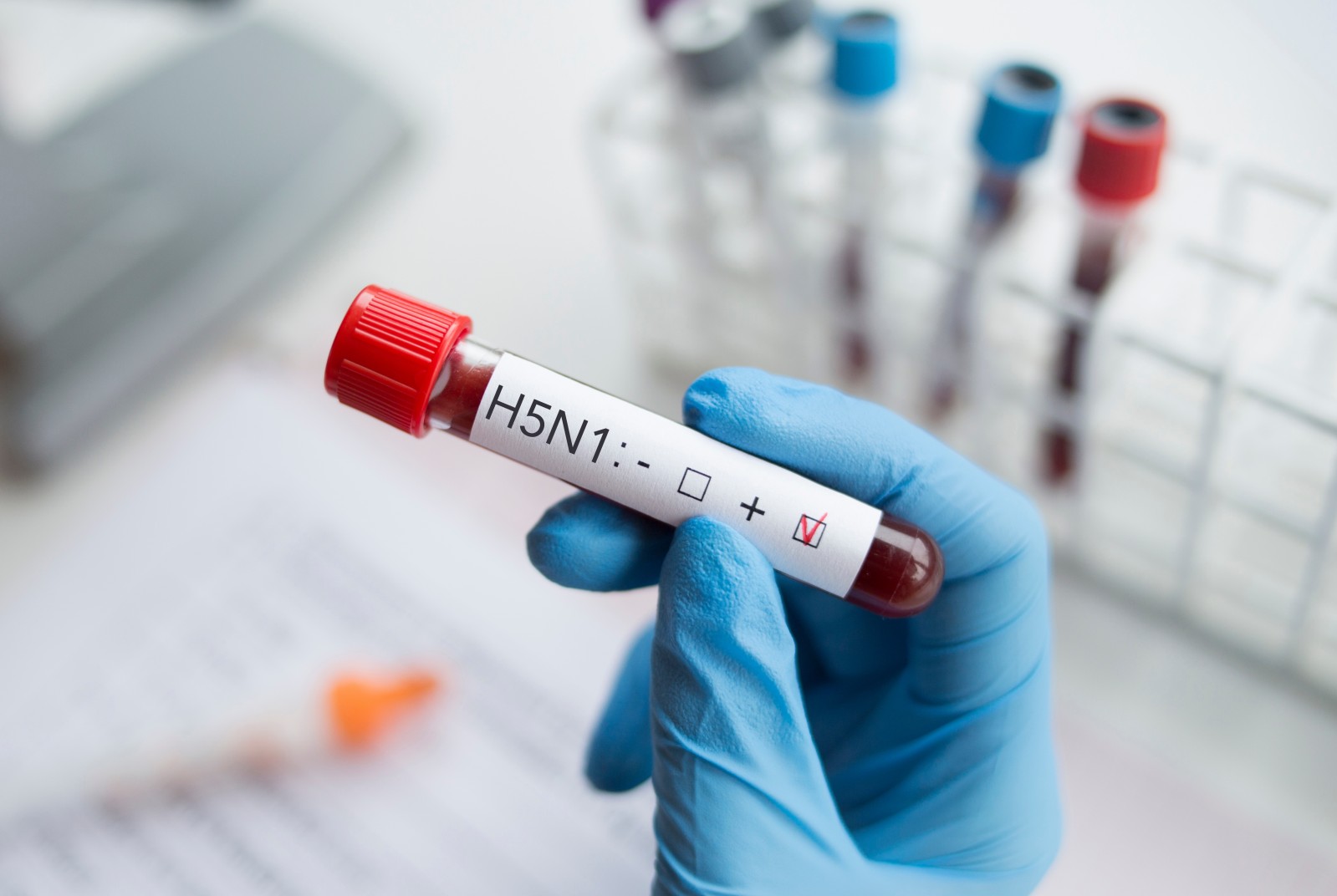 H5N1禽流感　哺乳動物互相傳染，人類也淪陷，該擔心嗎？